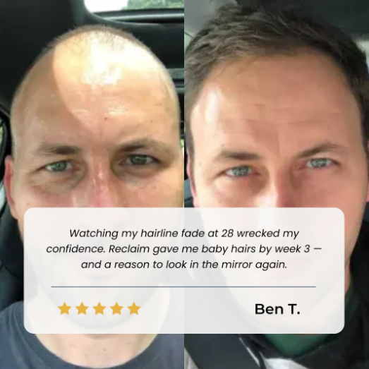Insideefy Hair Growth Roll on Serum