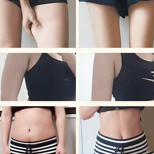 Skin tightening visible results