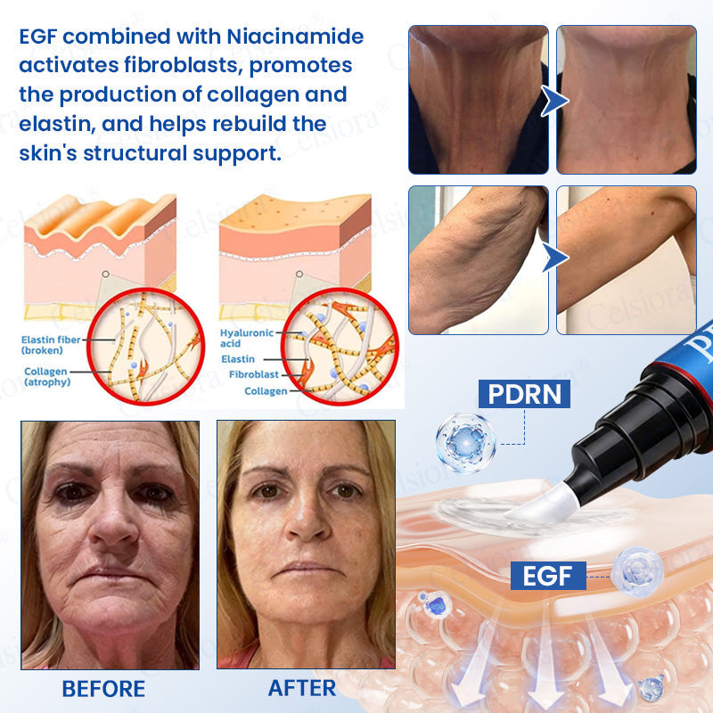 🥈🎁UK HOT SALE Insideefy® PDRN Anti-Wrinkle Shot – Lift & Firming Cream