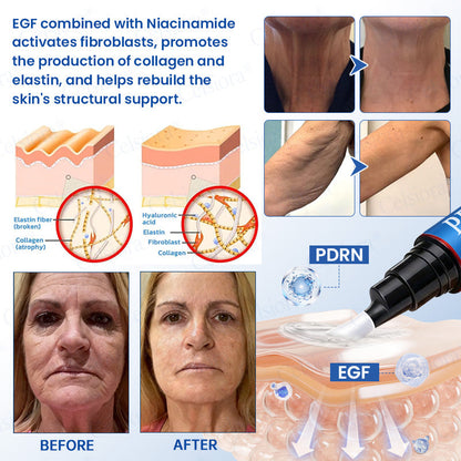 🥈🎁UK HOT SALE Insideefy® PDRN Anti-Wrinkle Shot – Lift & Firming Cream