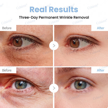 🥈🎁UK HOT SALE Insideefy® PDRN Anti-Wrinkle Shot – Lift & Firming Cream