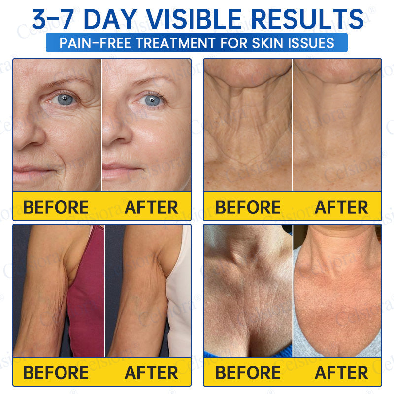 🥈🎁UK HOT SALE Insideefy® PDRN Anti-Wrinkle Shot – Lift & Firming Cream