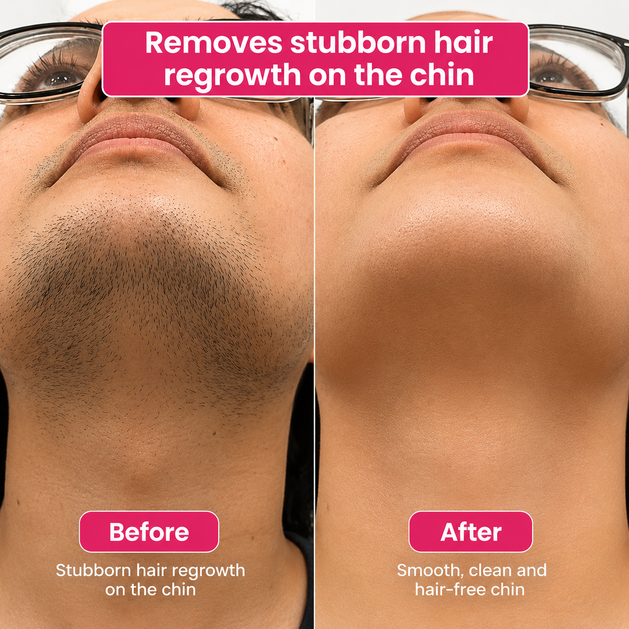 🔥LAST DAY 60% OFF  Lunarlumi Hair Reduction Oil 60 ml – Permanent Hair Removal Oil