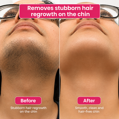 🔥LAST DAY 60% OFF  Lunarlumi Hair Reduction Oil 60 ml – Permanent Hair Removal Oil