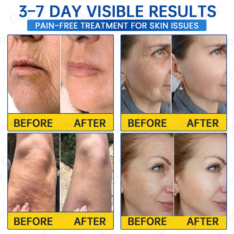 🥈🎁UK HOT SALE Insideefy® PDRN Anti-Wrinkle Shot – Lift & Firming Cream
