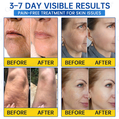 🥈🎁UK HOT SALE Insideefy® PDRN Anti-Wrinkle Shot – Lift & Firming Cream