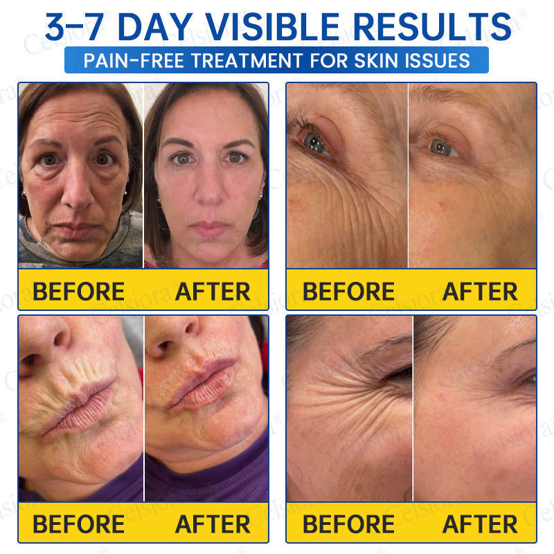 🥈🎁UK HOT SALE Insideefy® PDRN Anti-Wrinkle Shot – Lift & Firming Cream