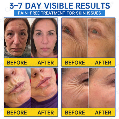 🥈🎁UK HOT SALE Insideefy® PDRN Anti-Wrinkle Shot – Lift & Firming Cream