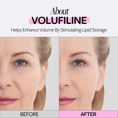Insideefy 100% Volufiline Ampoule – Natural Skin Plumping Serum for Fuller, Firmer & Youthful-Looking Skin